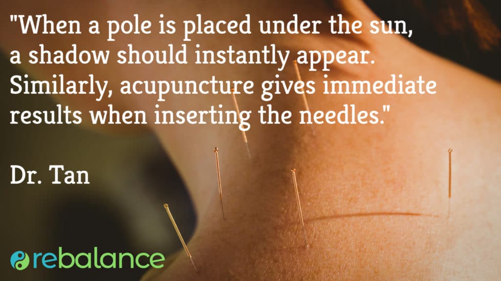 Balance Method Acupuncture