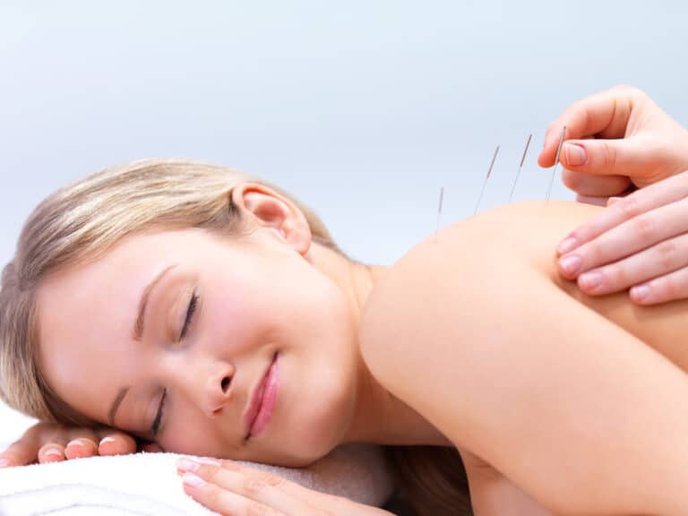 Acupuncture for Insomnia in Edmonton